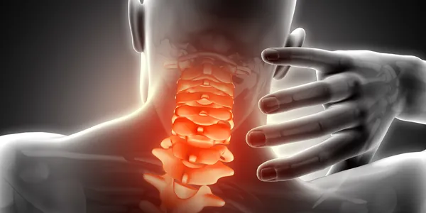 Ilustração de dor na coluna cervical